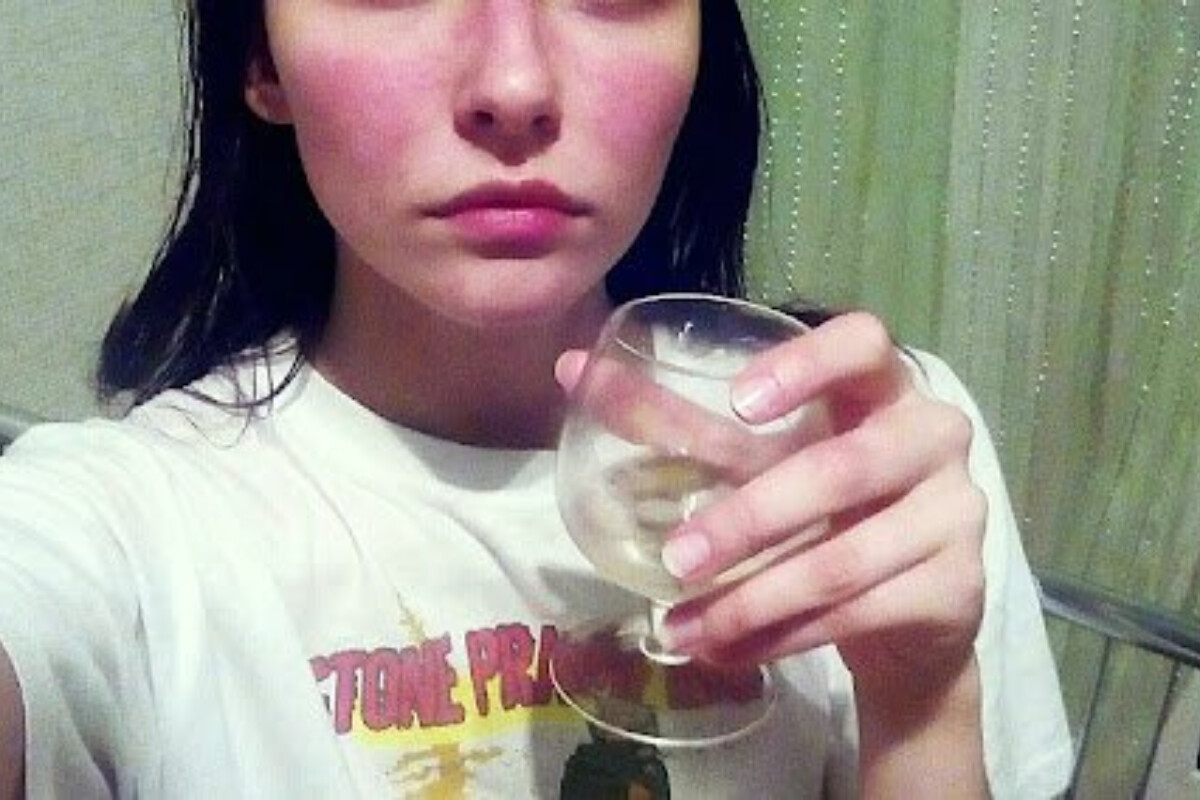 <p>Alkoqol allergiyası barədə xəbərdarlıq edən 5 dəri əlaməti</p>