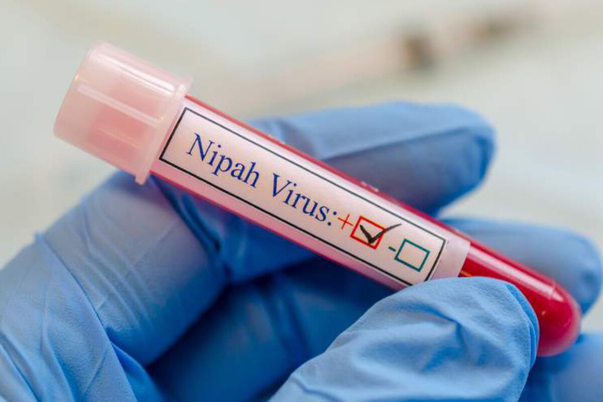 <p>Taylandda ölümcül Nipah virusunun daşıyıcısı müəyyən edilib</p>