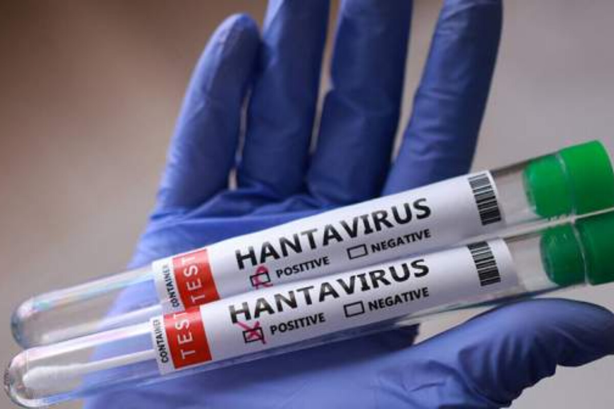 <p>Hantavirus İspaniyaya çatıb</p>