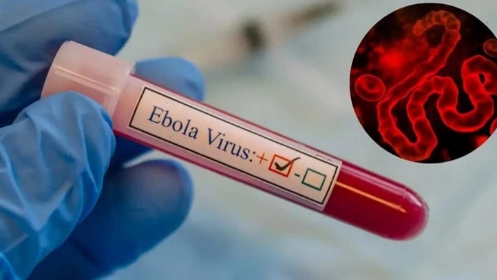 <p>Ebola virusu Avropa və Asiyaya yayıla bilər</p>